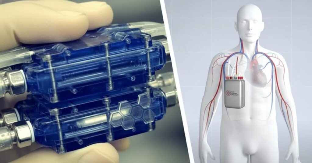 rene bioartificiale